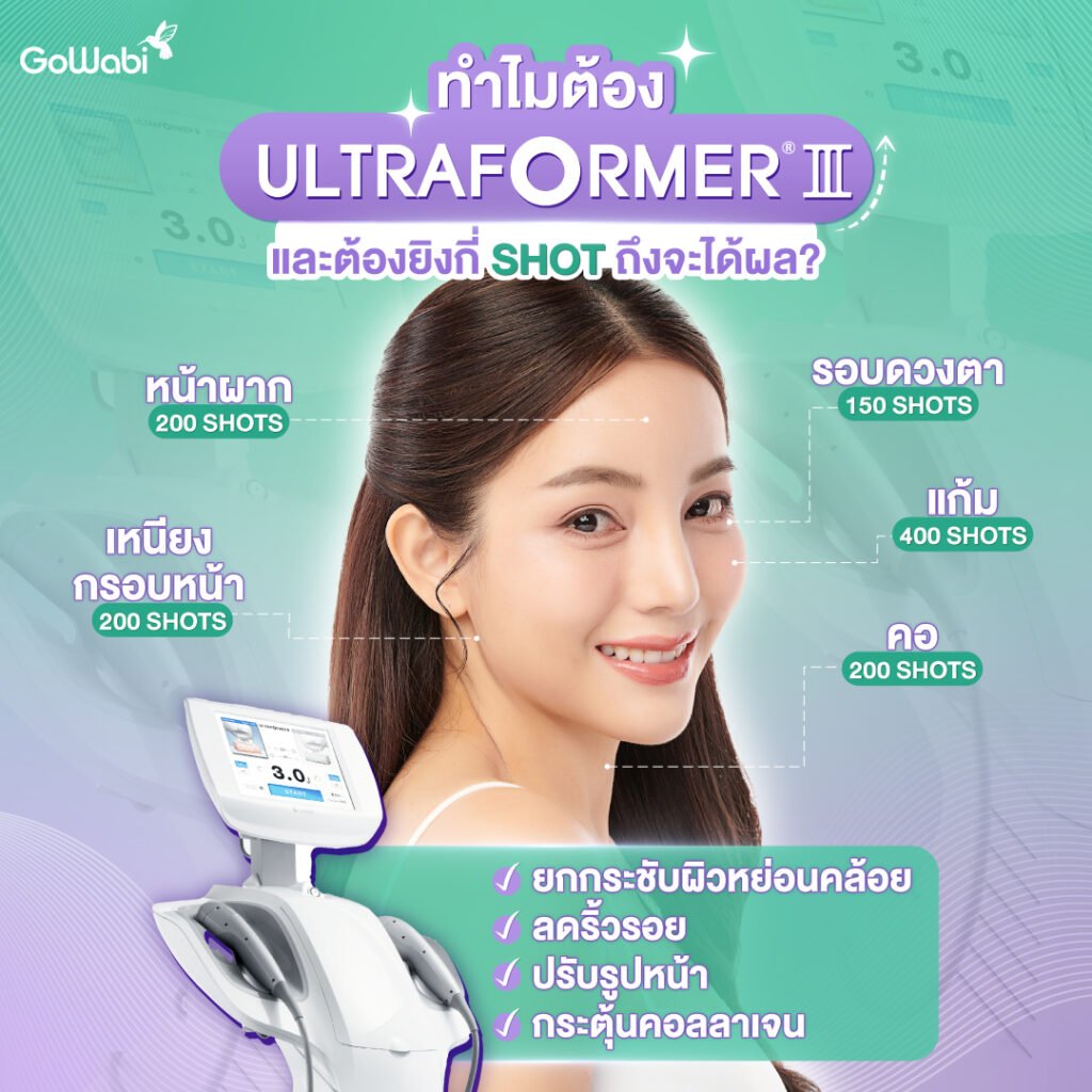 เครื่อง Ultraformer III ช่วยอะไรบ้างตำแหน่งไหนยิงกี่ช็อต