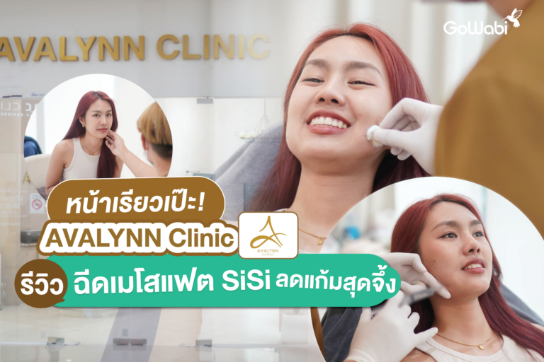 หน้าเรียวเป๊ะ! AVALYNN Clinic รีวิวฉีดเมโสแฟต SiSi ลดแก้มสุดจึ้ง